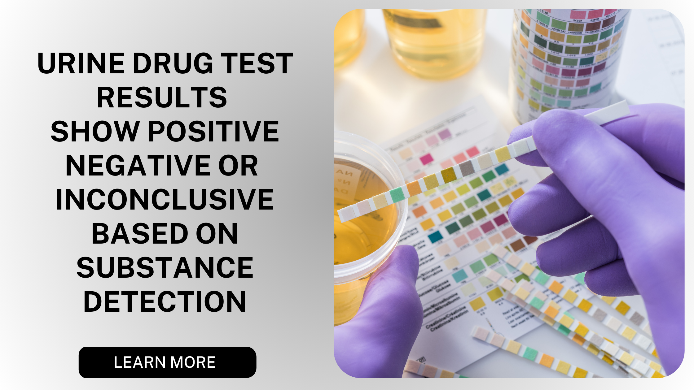 Urine Drug Test Results Explained: What You Need to Know